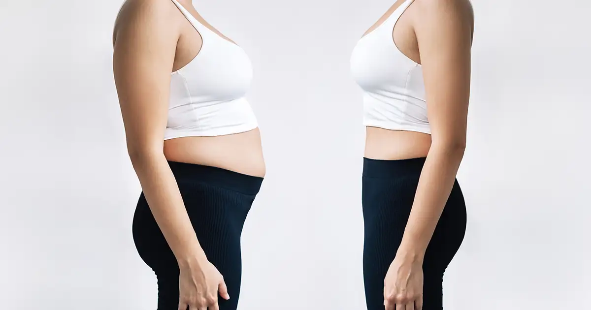 Cirurgia bariátrica Turquia segura